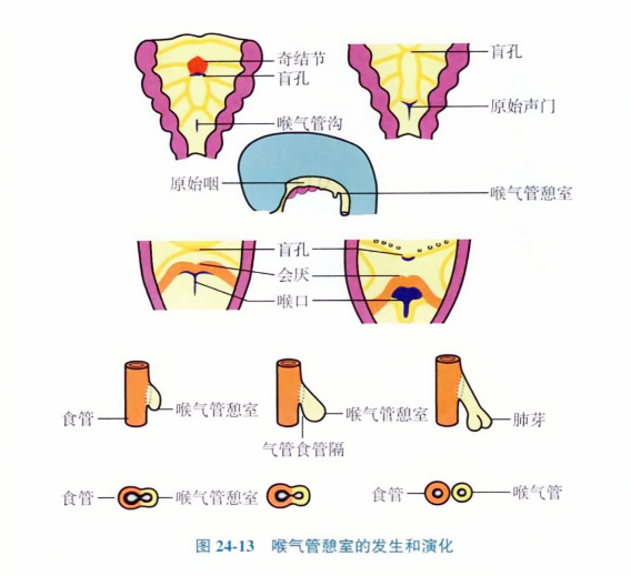 气管旁憩室的形成与影响因素探讨