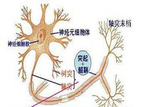 运动神经元病详解及优化策略，常见类型与应对之道